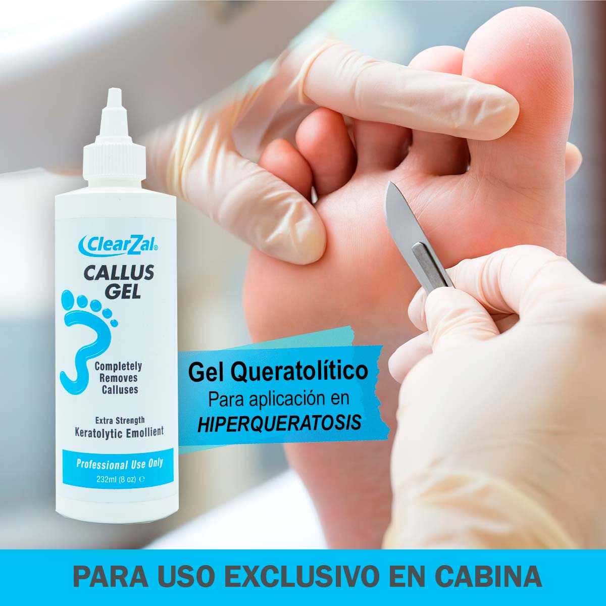 ClearZal Removedor de Callos Profesional