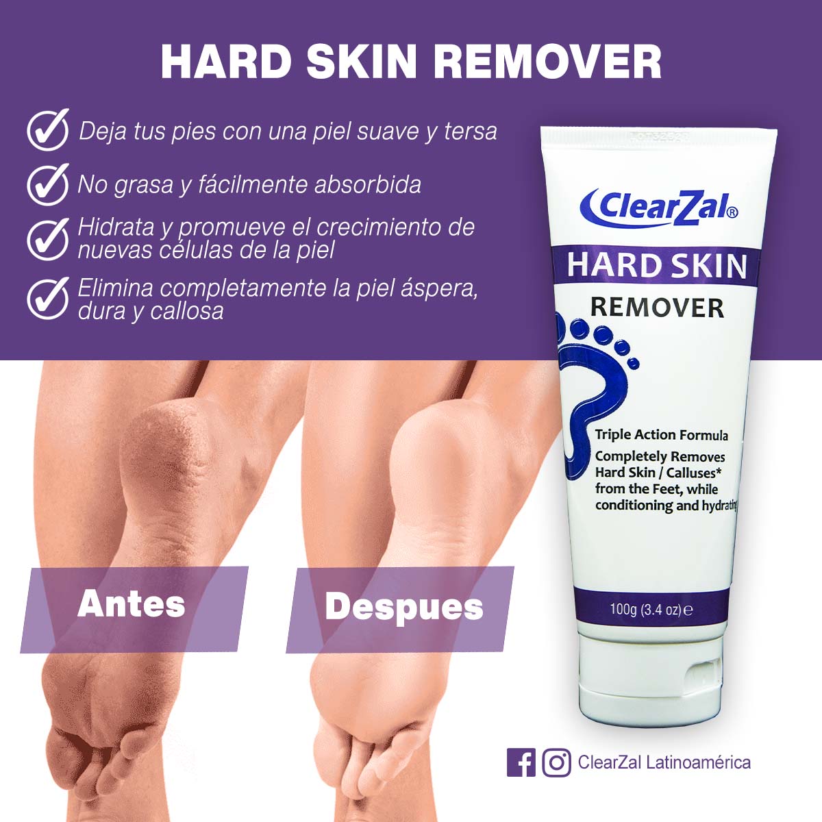 ClearZal Crema Removedora de Callos