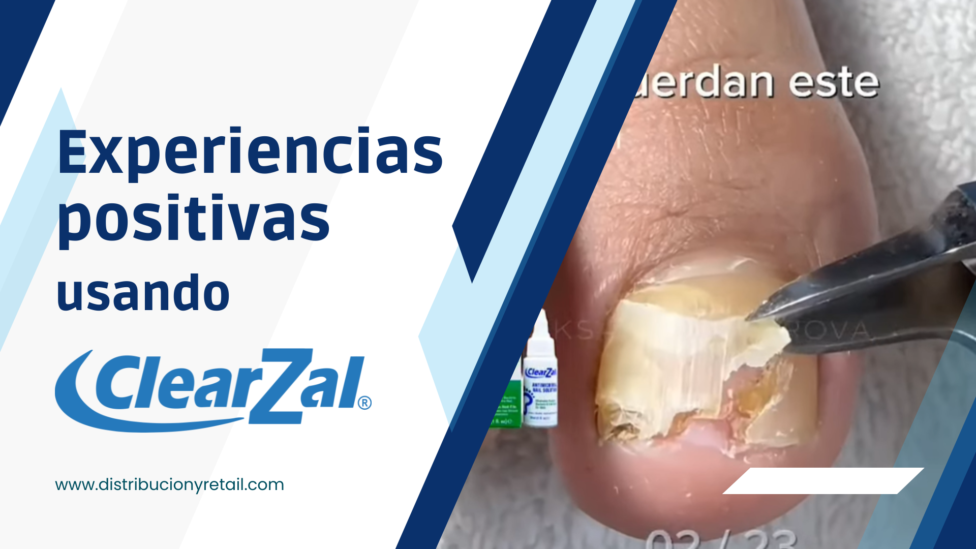 Cargar video: 