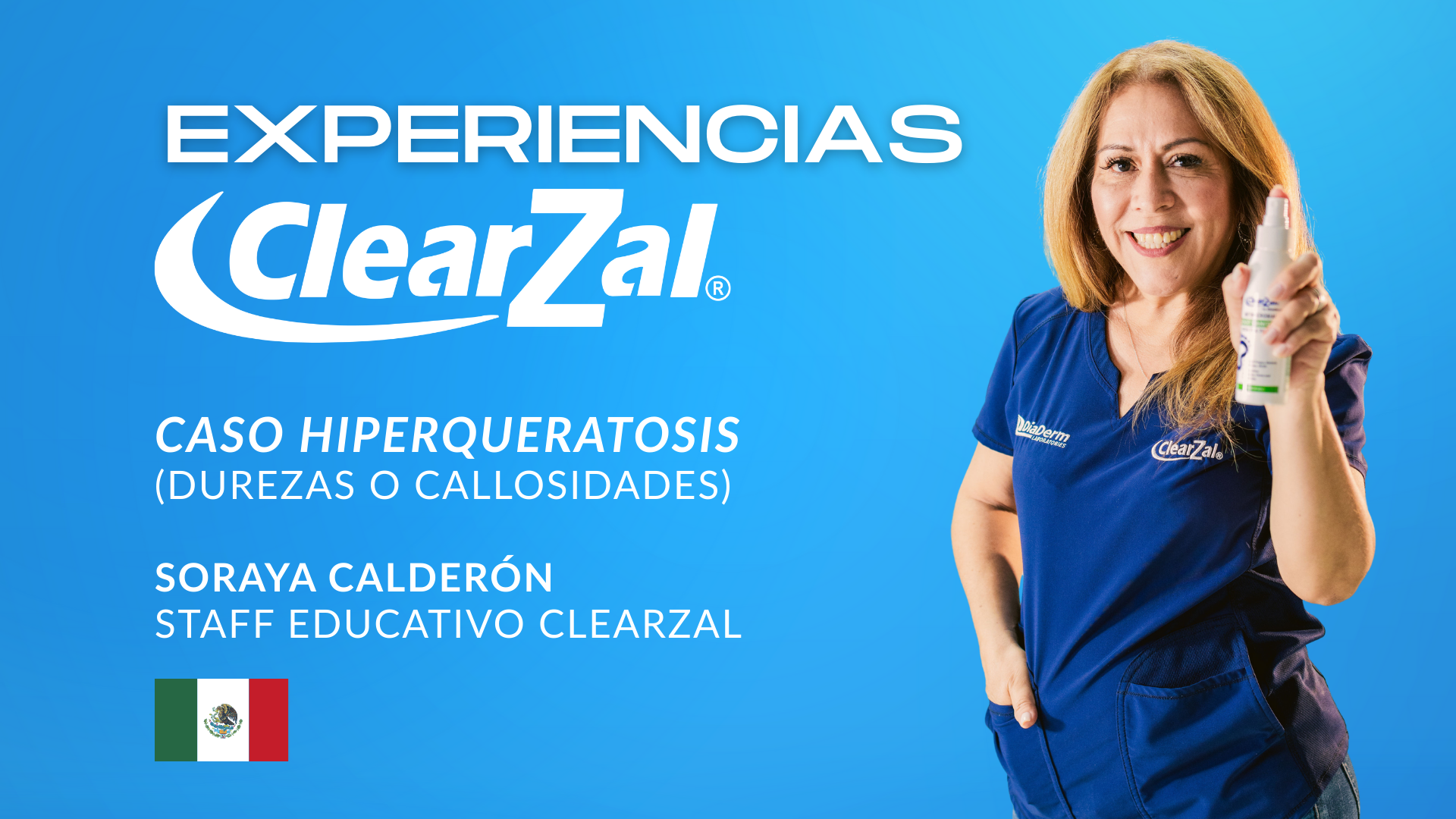 Cargar video: 