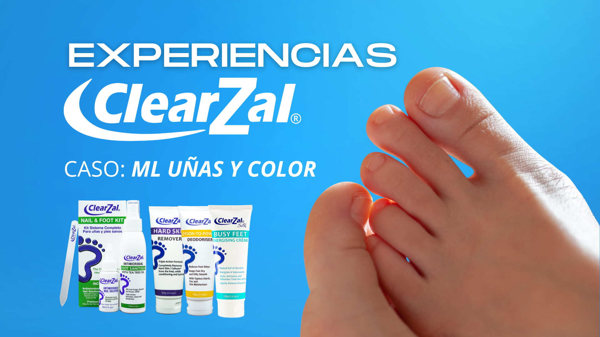 Cargar video: 